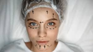 Perfilização Facial: o que é, cuidados e resultados naturais