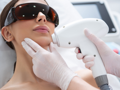 Depilação a Laser Antes e Depois Rosto