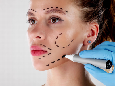 Harmonização Facial Full Face