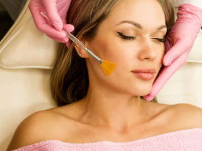 Peeling Químico